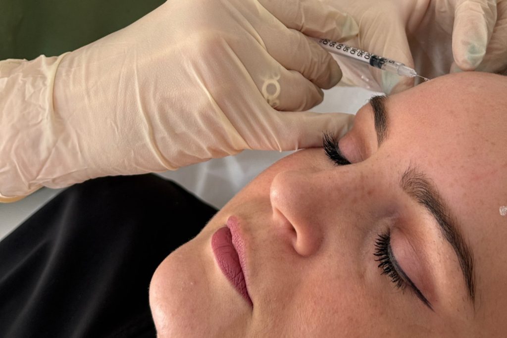 Refine Aesthetics Anti Wrinkle Treatments