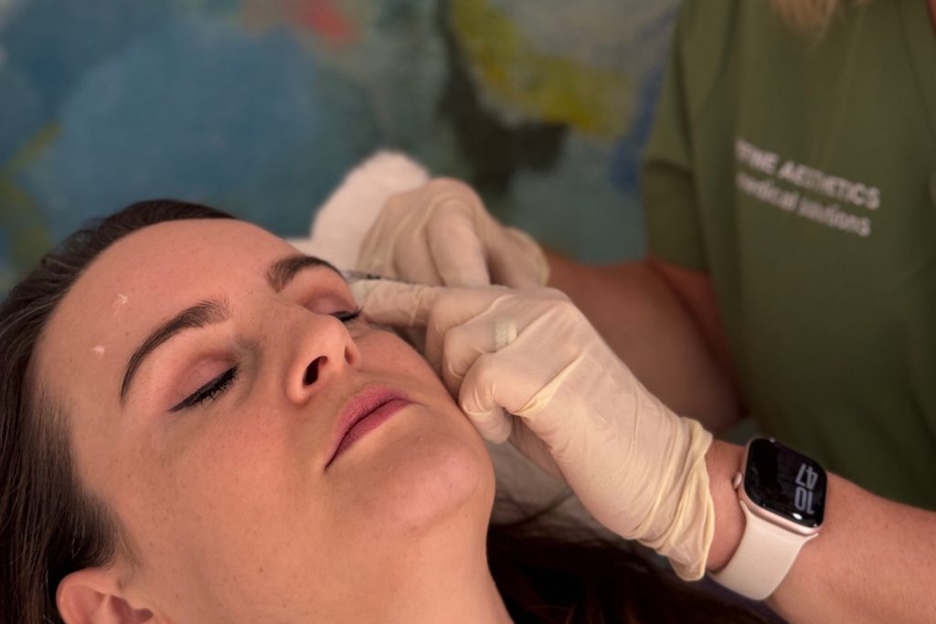 Refine Aesthetics Profhilo Treatments
